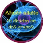Anvil motor de videojuegos